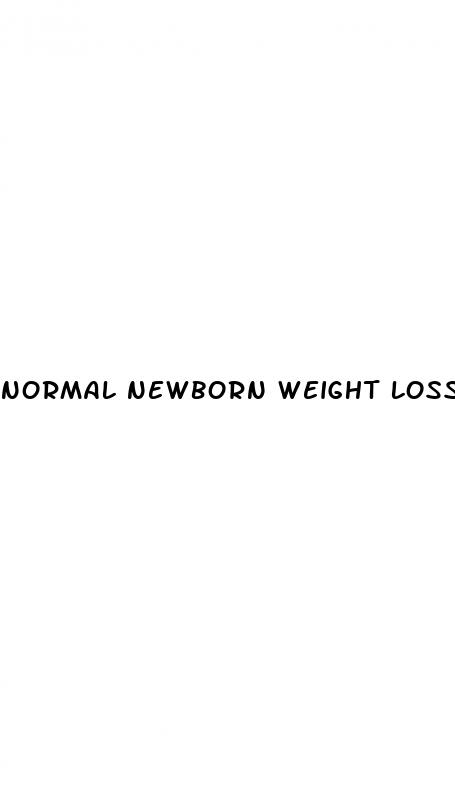 normal newborn weight loss