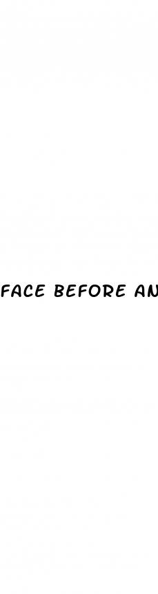 face before and after weight loss