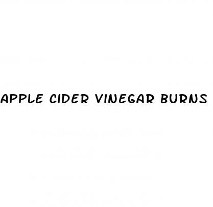 apple cider vinegar burns fat