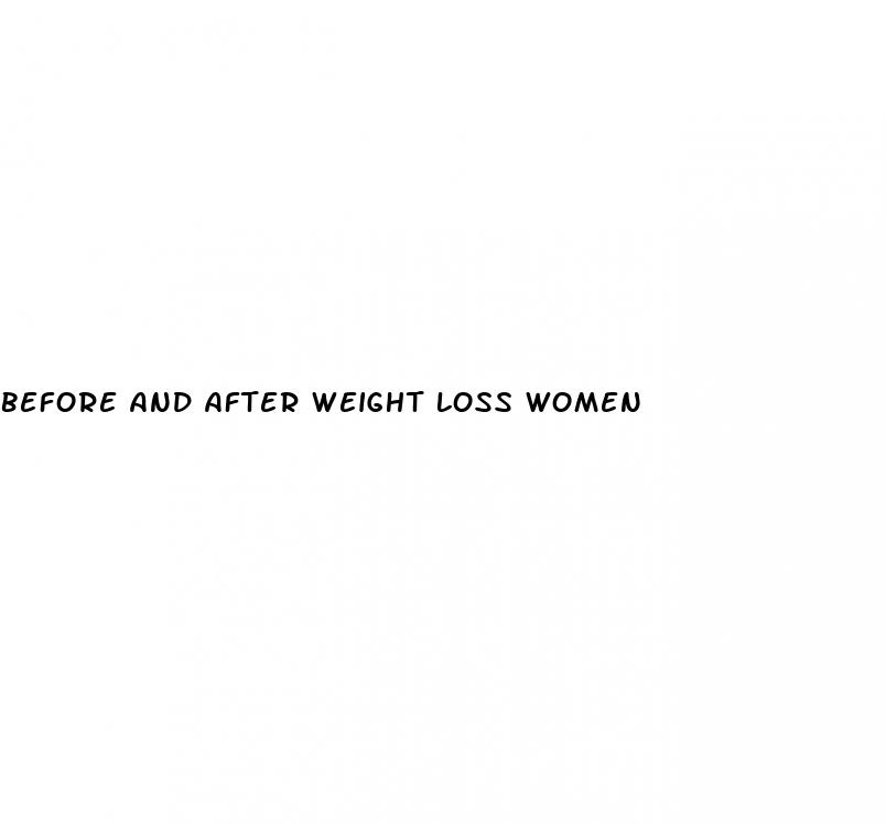 before and after weight loss women