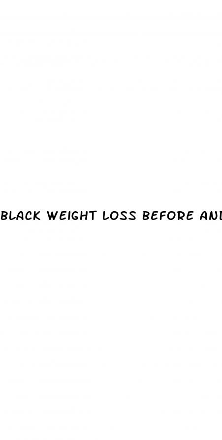 black weight loss before and after
