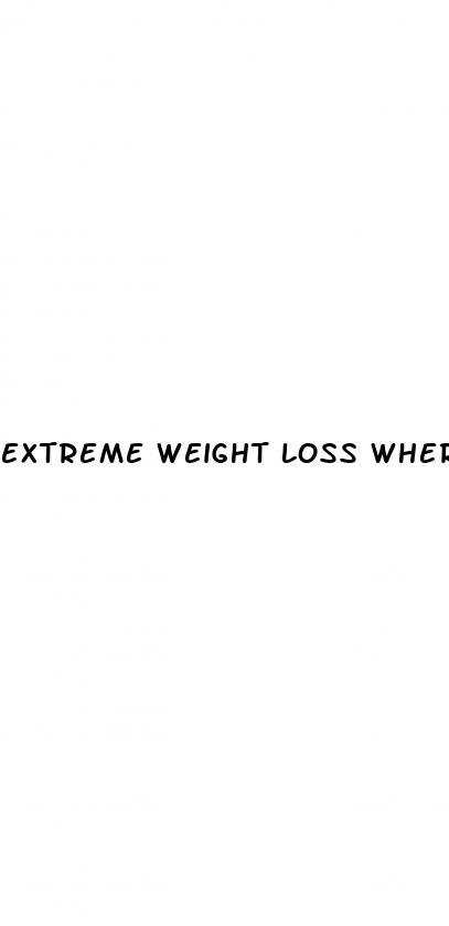 extreme weight loss where are they now