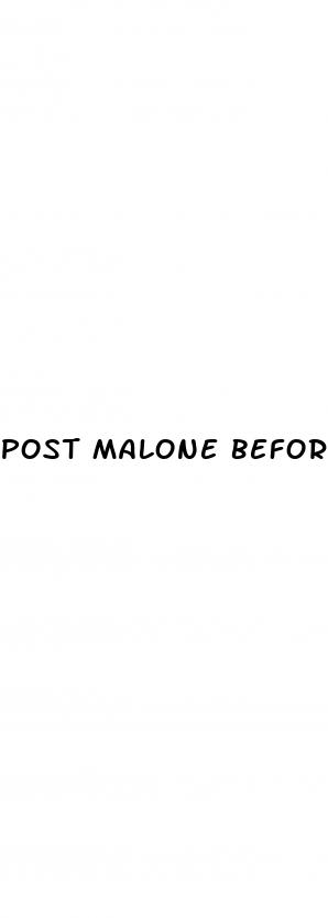 post malone before weight loss