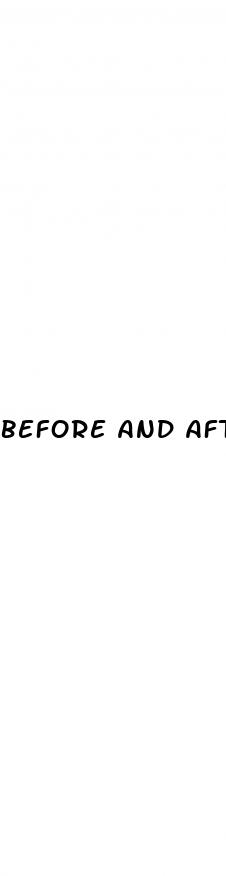 before and after weight loss