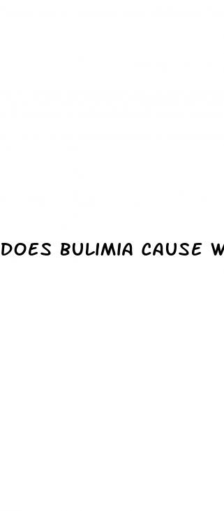 does bulimia cause weight loss