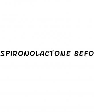 spironolactone before and after weight loss