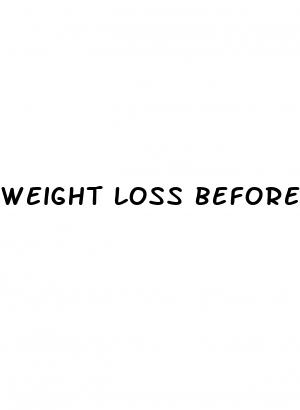 weight loss before and after