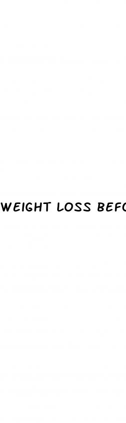 weight loss before and after cpap machine