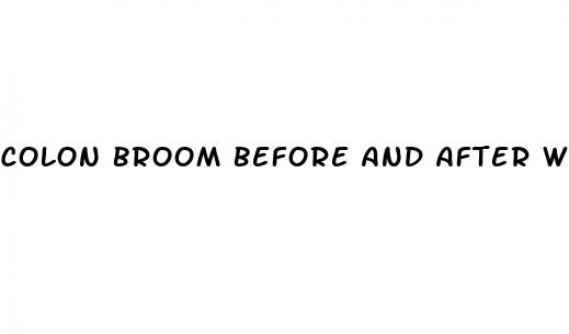 colon broom before and after weight loss