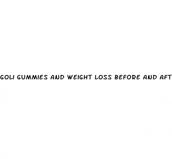 goli gummies and weight loss before and after