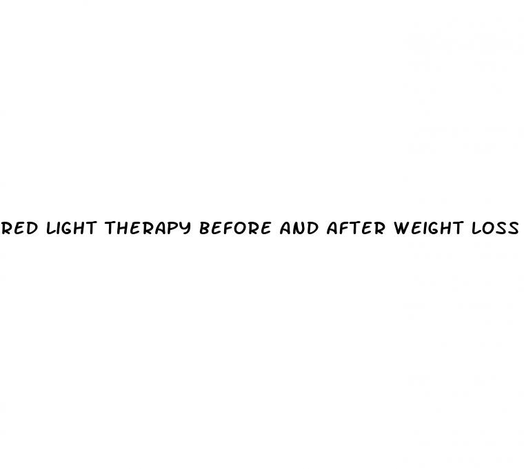 red light therapy before and after weight loss