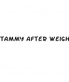 tammy after weight loss surgery