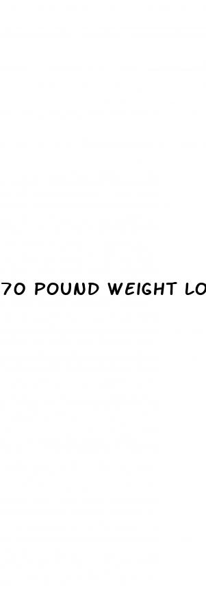 70 pound weight loss loose skin