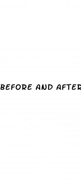 before and after saxenda weight loss results