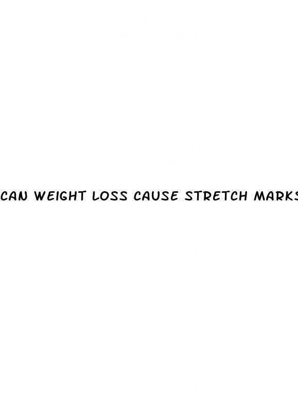 can weight loss cause stretch marks