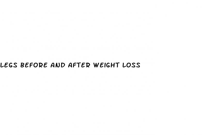 legs before and after weight loss