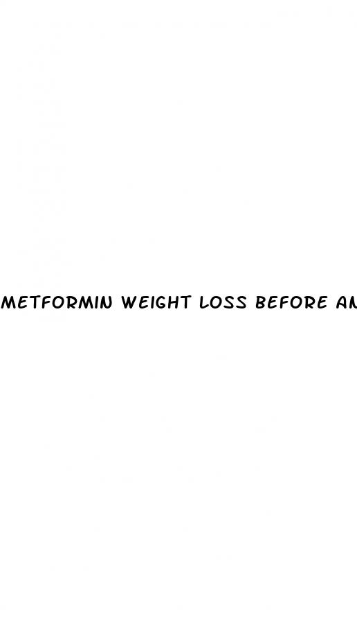 metformin weight loss before and after pictures