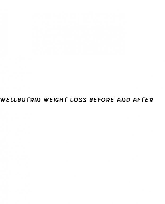 wellbutrin weight loss before and after