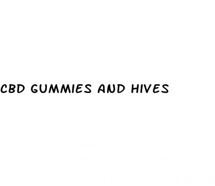 cbd gummies and hives