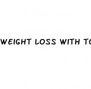 weight loss with topamax