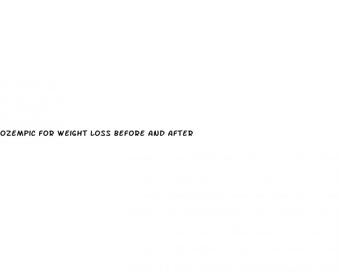 ozempic for weight loss before and after