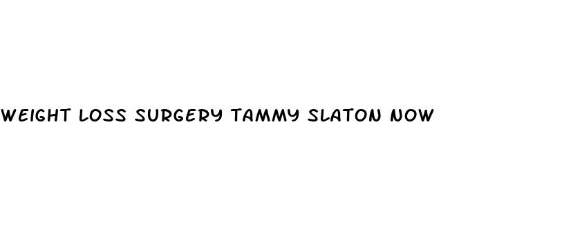weight loss surgery tammy slaton now