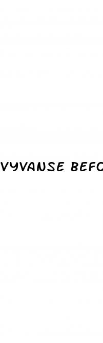 vyvanse before and after weight loss
