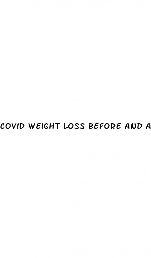 covid weight loss before and after