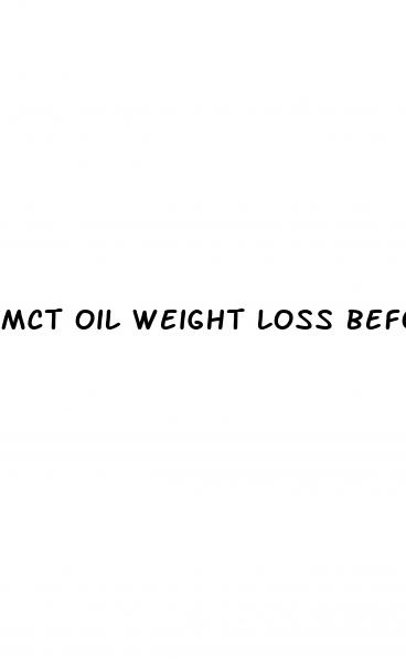 mct oil weight loss before and after