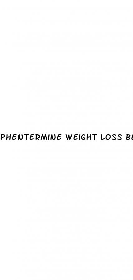 phentermine weight loss before and after