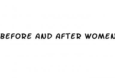 before and after women s weight loss