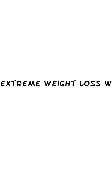 extreme weight loss without surgery