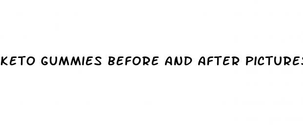 keto gummies before and after pictures