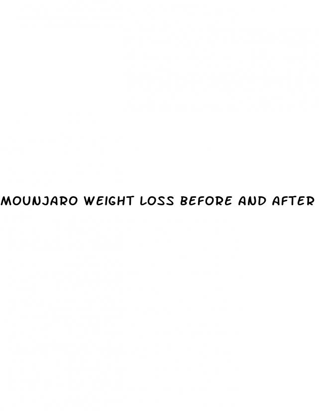 mounjaro weight loss before and after