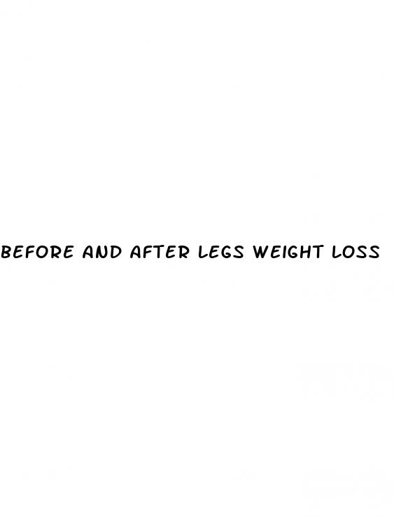 before and after legs weight loss