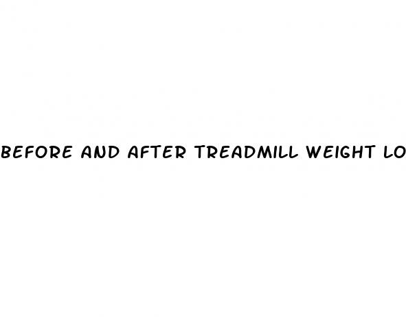 before and after treadmill weight loss