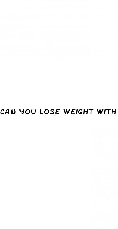 can you lose weight with intermittent fasting