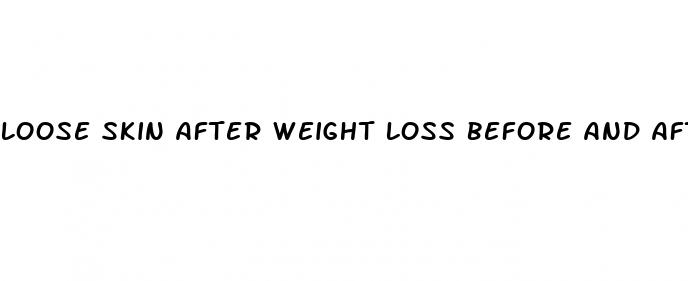 loose skin after weight loss before and after