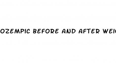 ozempic before and after weight loss pictures