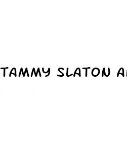 tammy slaton after weight loss