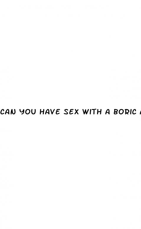 can you have sex with a boric acid pill in