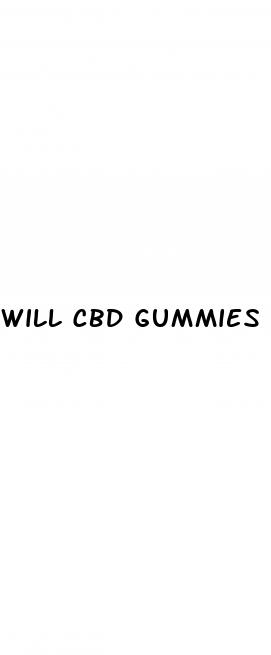 will cbd gummies help migraines