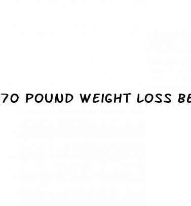 70 pound weight loss before and after