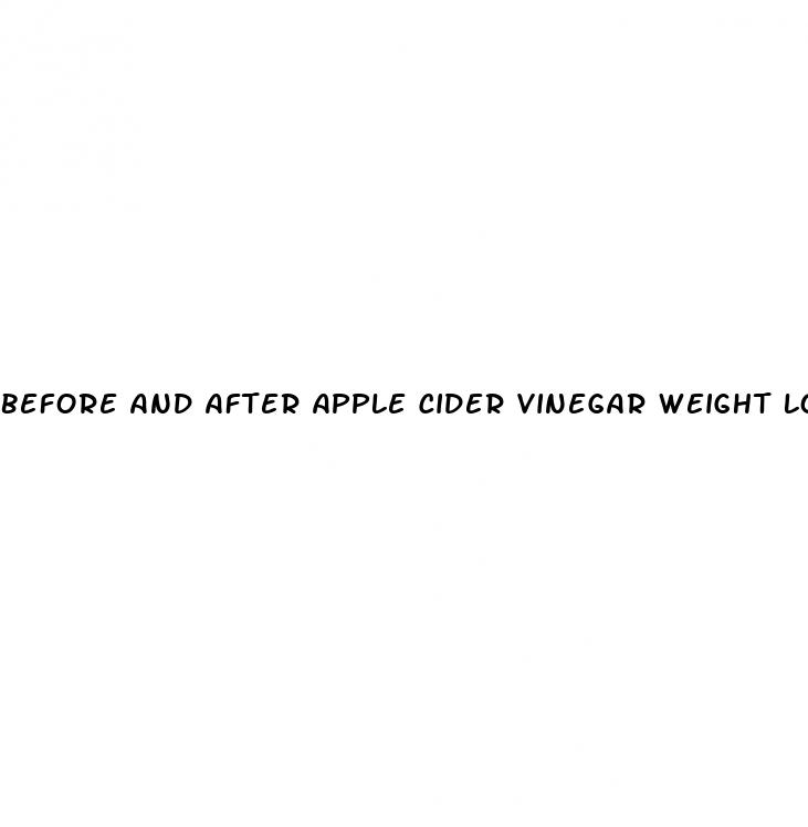 before and after apple cider vinegar weight loss