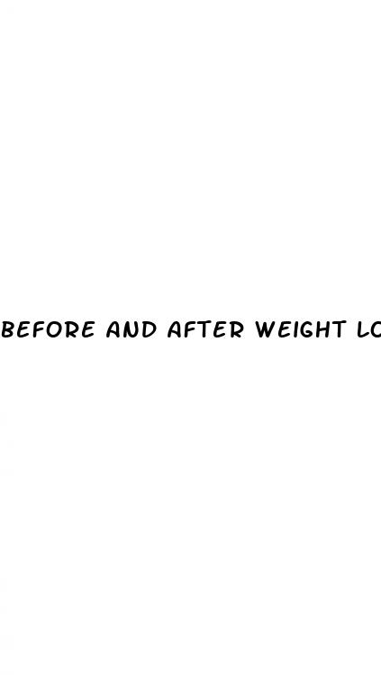 before and after weight loss pictures