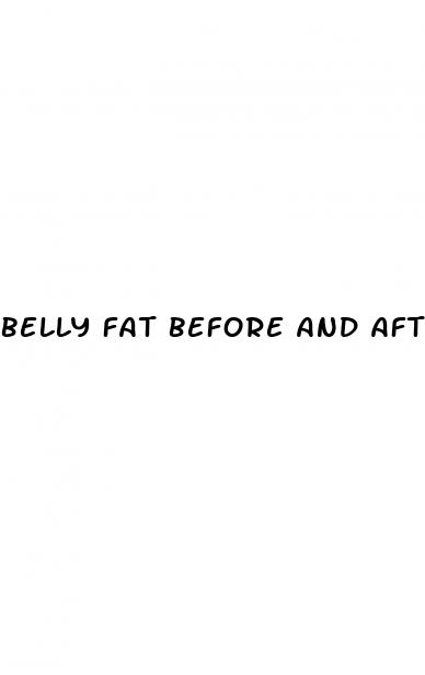 belly fat before and after metformin weight loss
