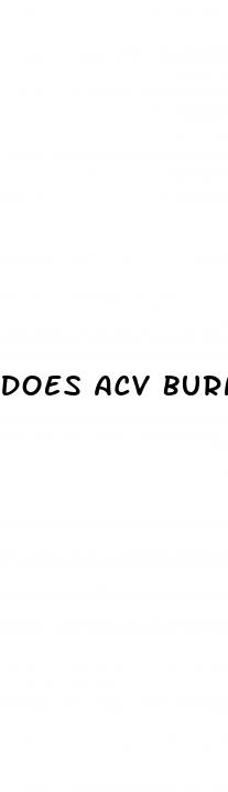 does acv burn belly fat