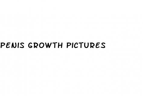penis growth pictures