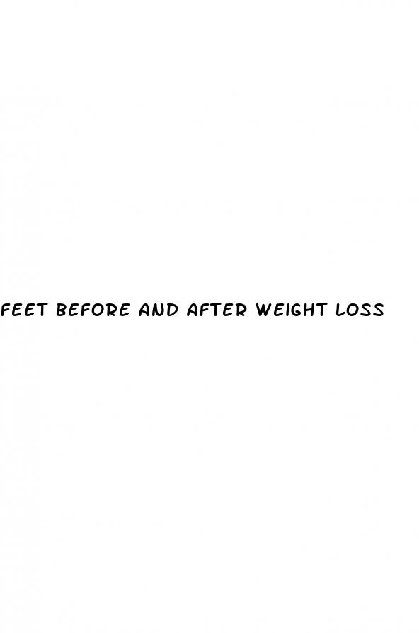 feet before and after weight loss