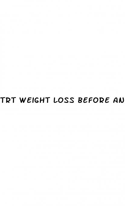 trt weight loss before and after